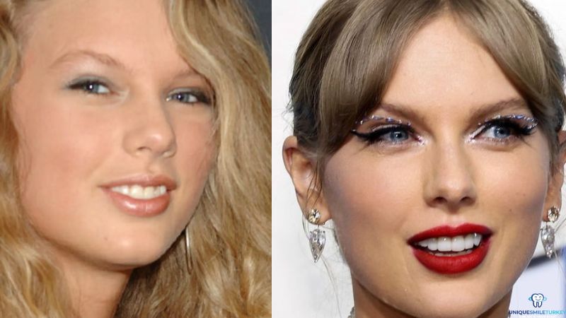 Taylor Swift Teeth Turkey